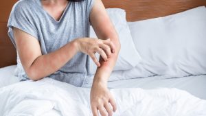 Why Are Body Lice Different From Head Lice?