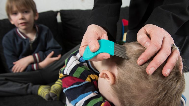 Why Won’t a Lice Egg Pop Like a Tick or Pimple?