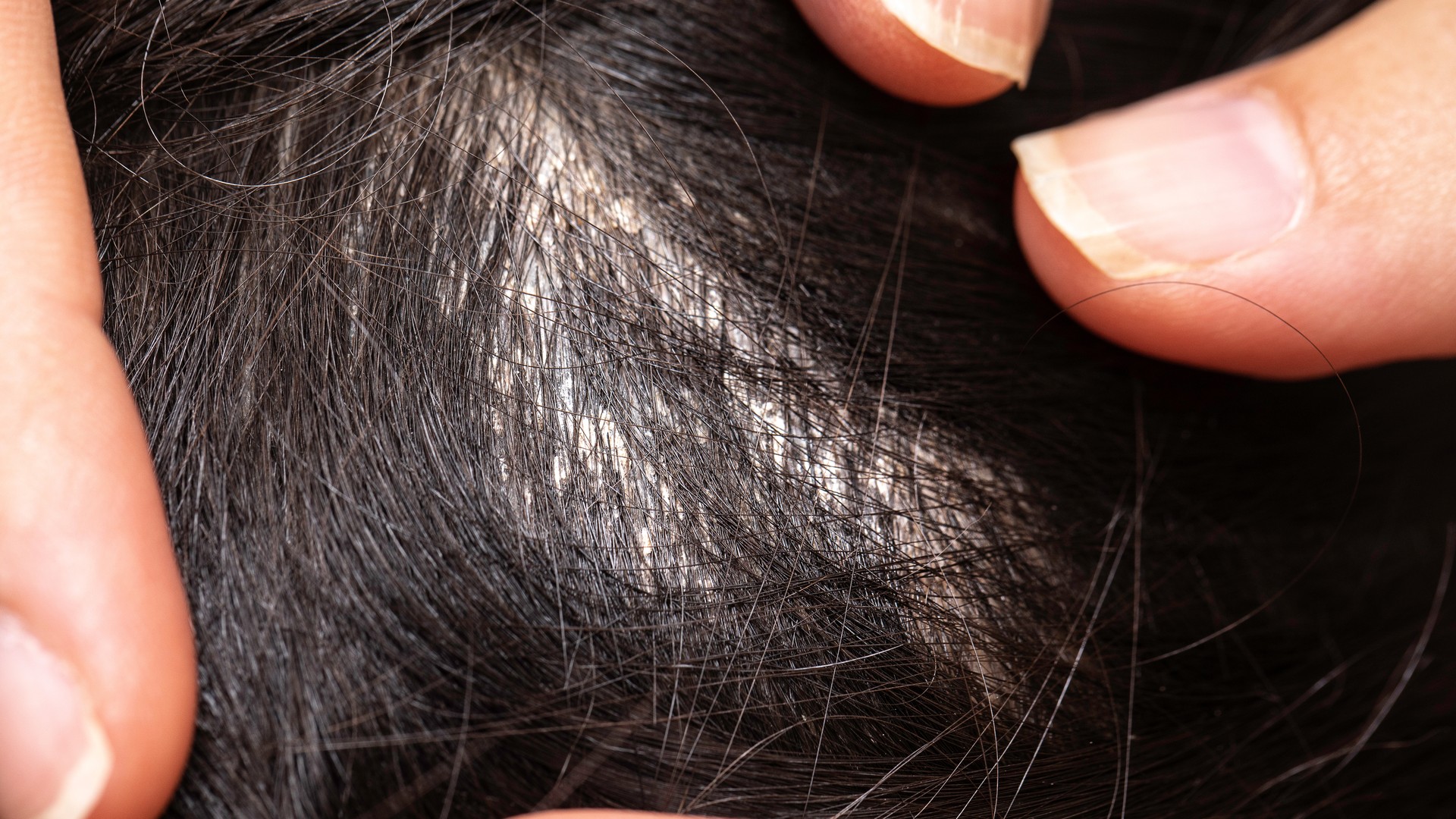 Parent parting a child's hair for a careful head lice check