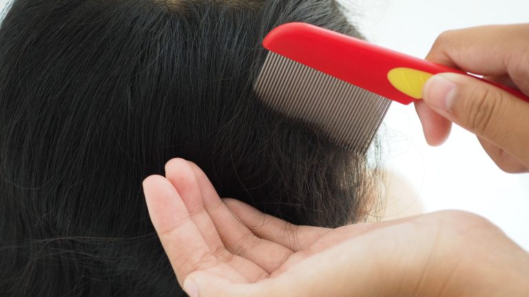 A Back-to-School Lice Check Can Spare the Whole Family
