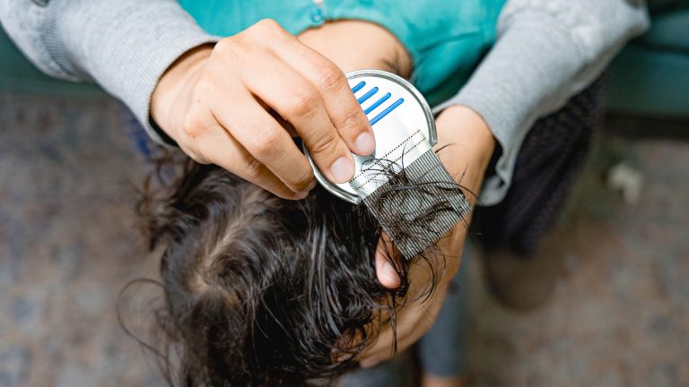 Does a Flat Iron Really Solve a Head Lice Outbreak?