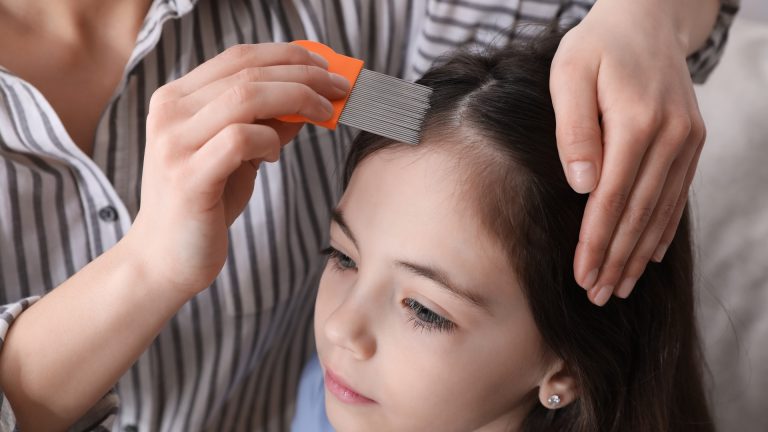 Lice Survive the Handoff Between Two Households
