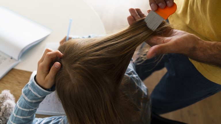 The Flea Comb Stops Catching Lice Before They’re Gone