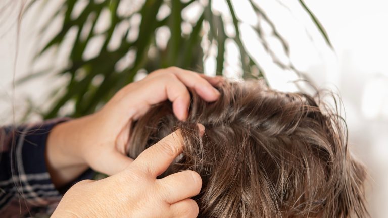 The Lice Call the School Can’t Make for You